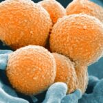 Καθ. Κωνσταντόπουλος για στρεπτόκοκκο: Σπανιότατο το περιστατικό θανάτου της 6χρονης