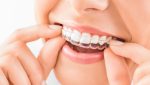 Invisalign: Η σωστή επιλογή για ένα ίσιο χαμόγελο, που θα εκπέμπει αυτοπεποίθηση