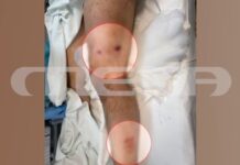 Κρήτη: Νέες φωτογραφίες από το μακελειό στα Βορίζια – MEGA ντοκουμέντο