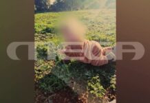 Ζάκυνθος: Πίτμπουλ κατασπάραξε 2χρονο αγοράκι