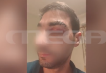 Αίγιο: Ασθενής – μποξέρ χτυπούσε επί 20 λεπτά γιατρό – Τον έστειλε στο χειρουργείο