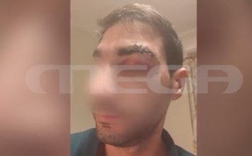 Αίγιο: Ασθενής – μποξέρ χτυπούσε επί 20 λεπτά γιατρό – Τον έστειλε στο χειρουργείο