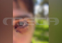 Ιωάννινα: Σοκάρει στο MEGA ο 16χρονος που δέχθηκε άγρια επίθεση από ομάδα ανηλίκων