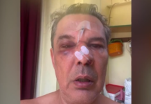 Χαϊδάρι: «Μου ‘χει σπάσει το κόκκαλο στη μύτη» – Τι λέει ο άνδρας που έπεσε θύμα ξυλοδαρμού μέσα σε ιατρείο