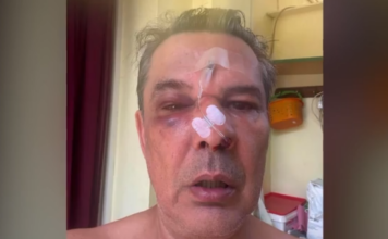 Χαϊδάρι: «Μου ‘χει σπάσει το κόκκαλο στη μύτη» – Τι λέει ο άνδρας που έπεσε θύμα ξυλοδαρμού μέσα σε ιατρείο