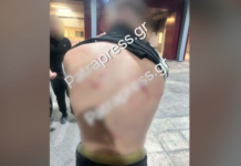 Πάτρα: Επίθεση σε 18χρονο με κατσαβίδι – Φέρει 13 χτυπήματα